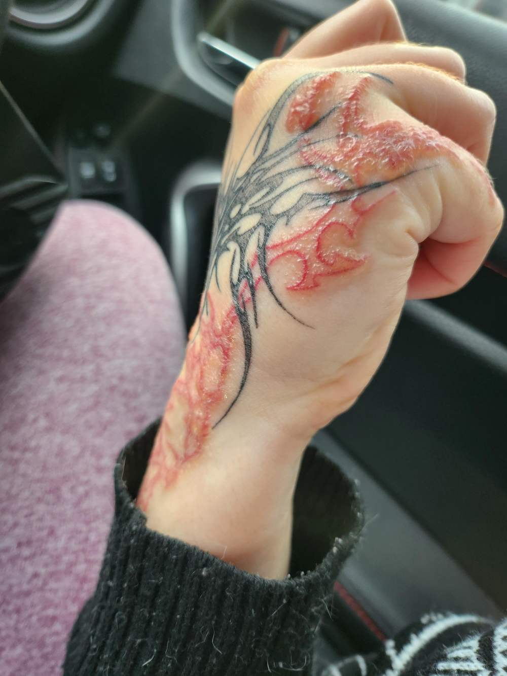 Why My Tattoo Is Itchy? How to Calm It Safely Why My Tattoo Is Itchy? How to Calm It Safely
