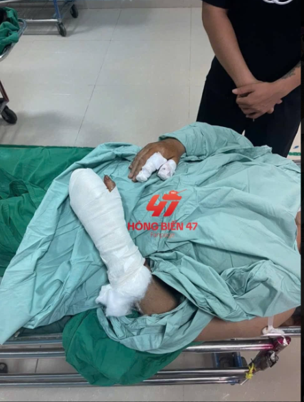 Đắk Lắk: Bàng hoàng vụ người phụ nữ đi đường bị chém đứt lìa ngón tay tại chợ Đê Ea Kao Đắk Lắk: Bàng hoàng vụ người phụ nữ đi đường bị chém đứt lìa ngón tay tại chợ Đê Ea Kao