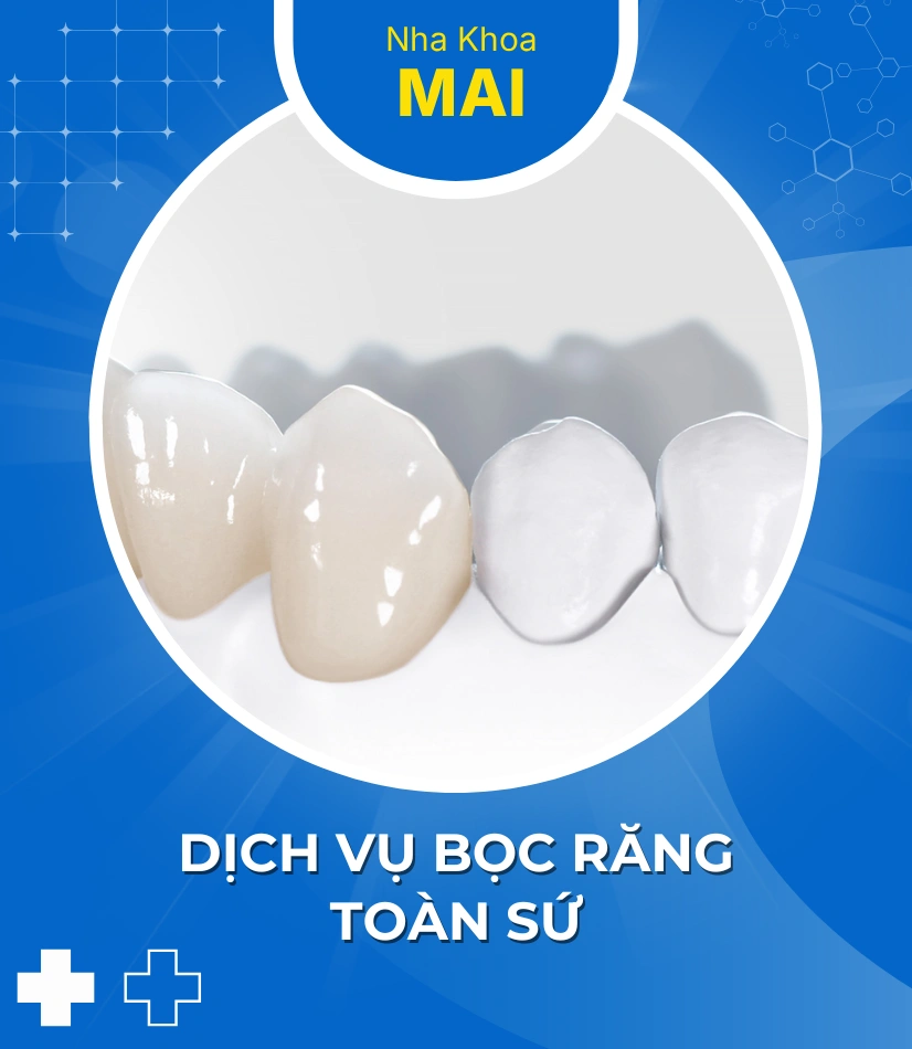 Dịch vụ bọc răng toàn sứ