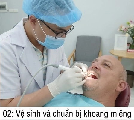 quy-trinh-rang-gia-thao-lap2