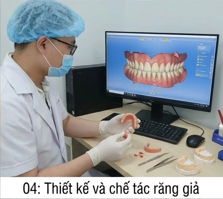 quy-trinh-rang-gia-thao-lap4