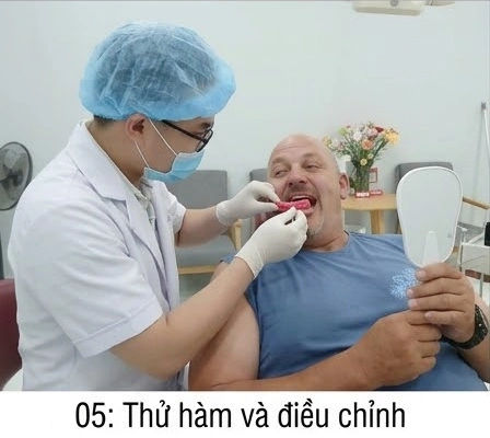 quy-trinh-rang-gia-thao-lap5
