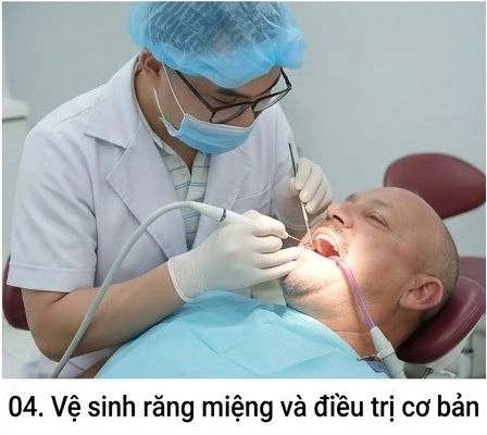 quy-trinh-nha-khoa-tong-quat4