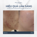 Kem dưỡng ẩm phục hồi hàng rào bảo vệ da VIBANQM LOTION HYBRID LOTION 30ml - Ảnh 5