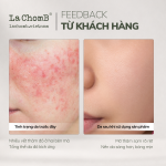 Kem dưỡng làm dịu phục hồi La Blanche Calming Moisture repair cream 60ml - Ảnh 4