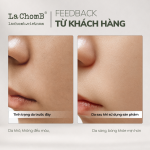 Kem nâng tông đa năng Pro-ClairRN Balm 35ml - Ảnh 5