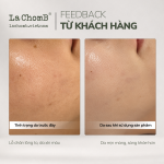 Kem dưỡng tái tạo phục hồi da Lafin Complete Renew Cream 35g - Ảnh 5