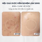 Bộ 3 làm sạch & phục hồi (minisize) CONAPIDIL Tutorial Kit 30ml - Ảnh 4